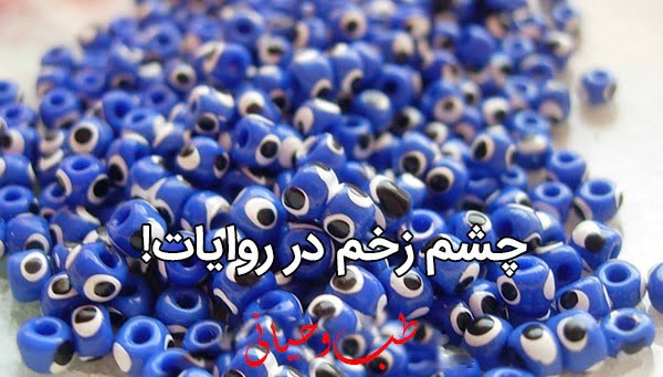 چشم زخم ، و درمان آن در طب اسلامی